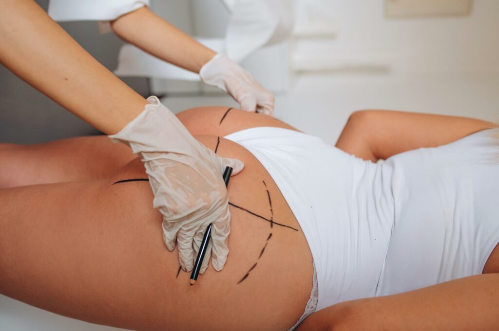trattamenti-estetici-corpo-a-Como